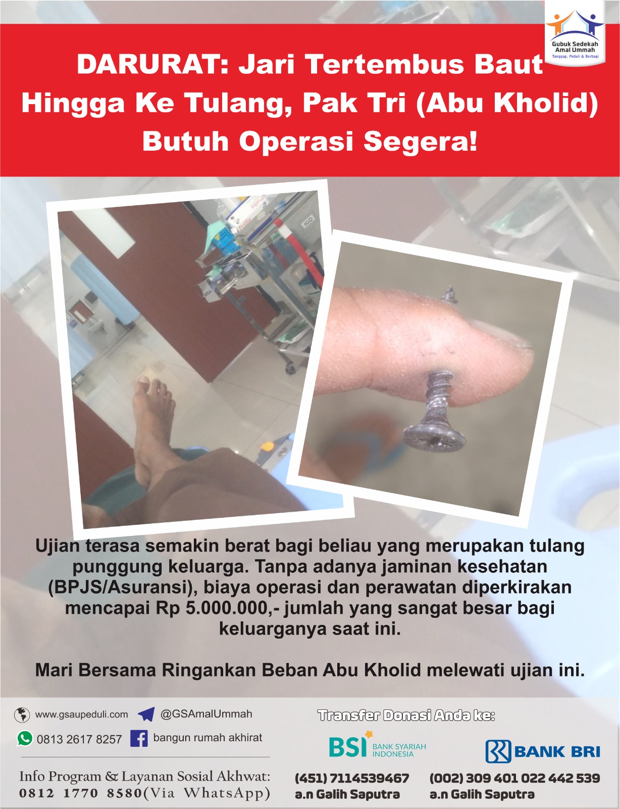 DARURAT: Jari Tertembus Baut Hingga Ke Tulang, Pak Tri (Abu Kholid) Butuh Operasi Segera!